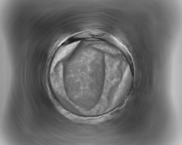 X0000085770001200704091402