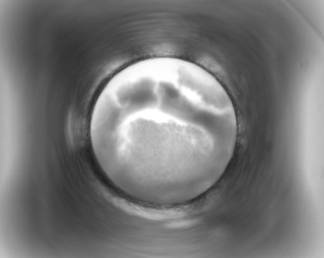 X0000085770012200704091401