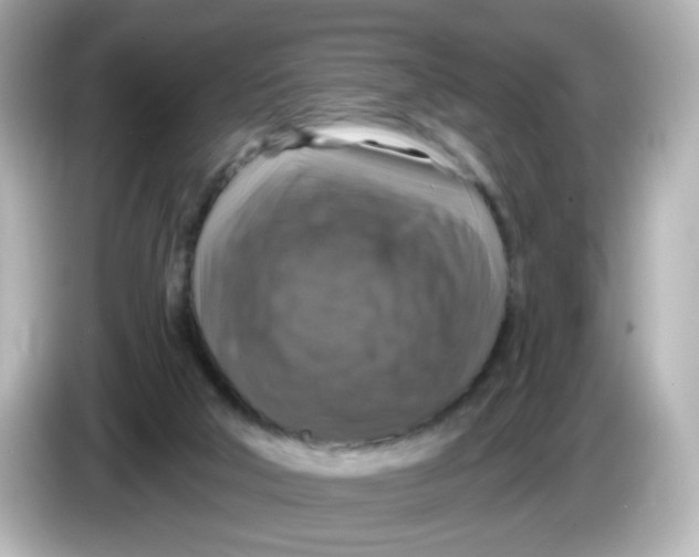 X0000085770018200704091401