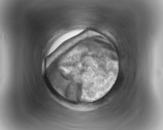 X0000085770020200704091401