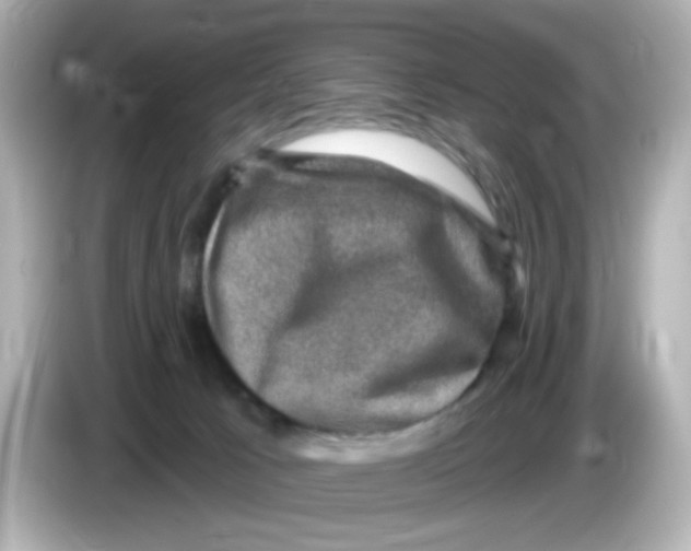 X0000085770033200704091401