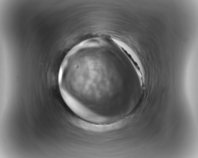 X0000085770039200704091401