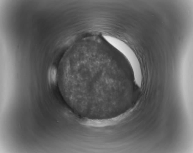 X0000085770041200704091401