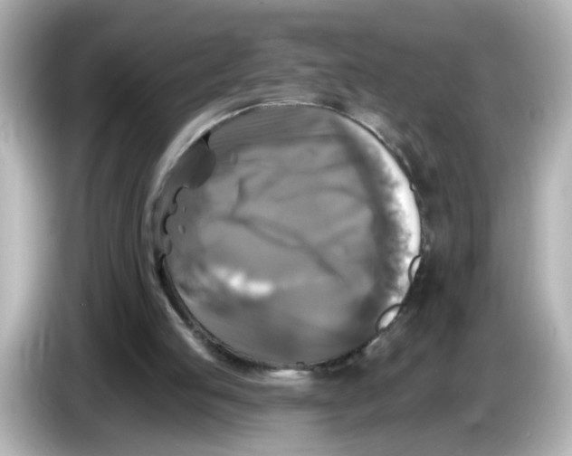 X0000085770053200704091400