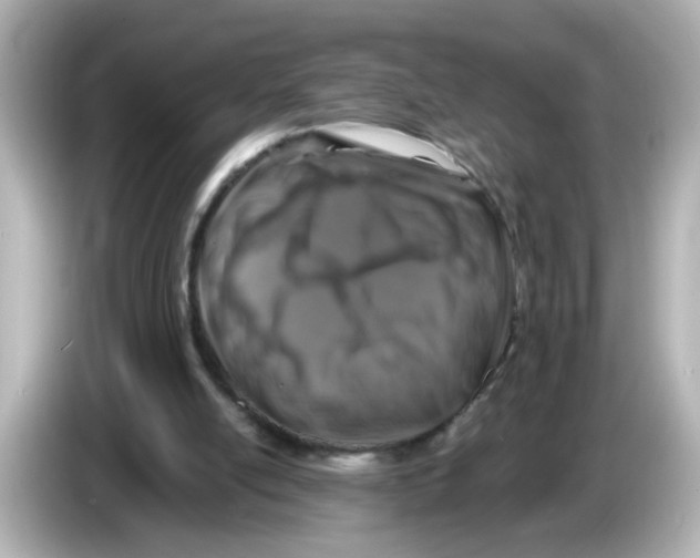 X0000085770054200704091400