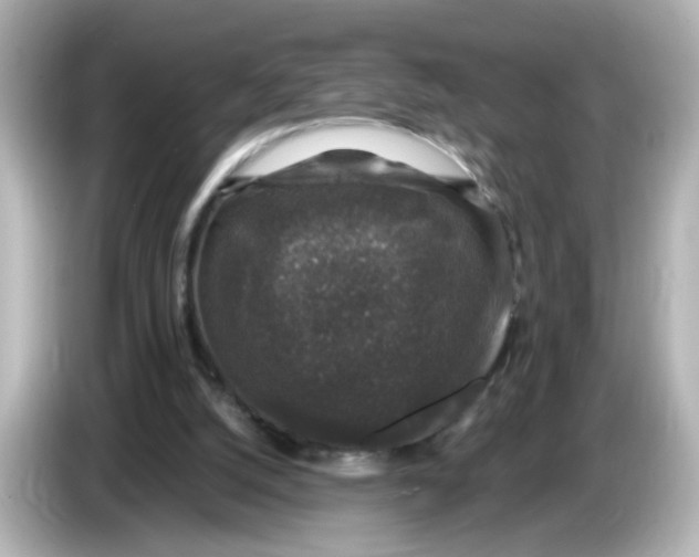 X0000085770056200704091400