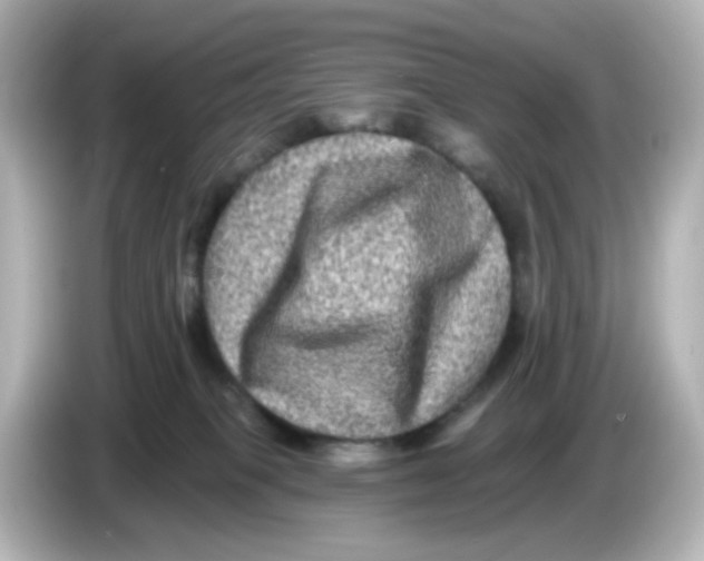 X0000085770085200704091401