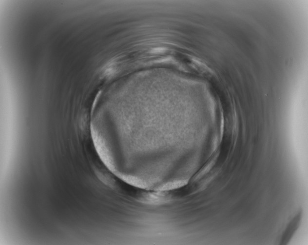 X0000085770092200704091401