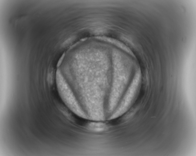 X0000085770133200704091400