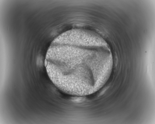 X0000085770135200704091400