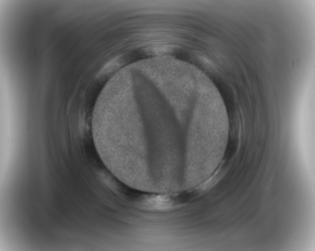 X0000085770140200704091359