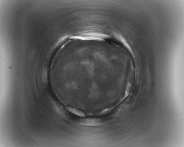 X0000085770154200704091359