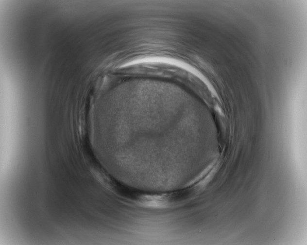 X0000085770170200704091359