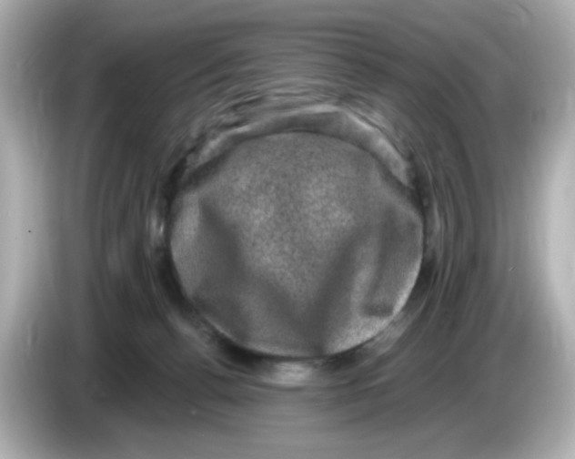 X0000085770176200704091359