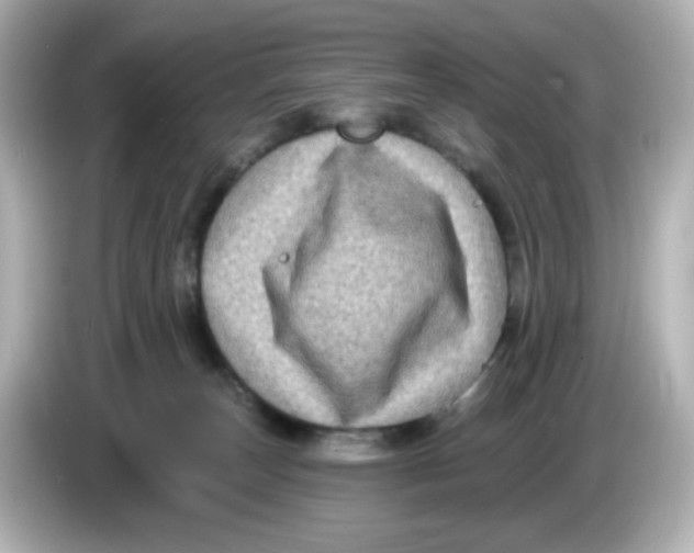 X0000085770179200704091359