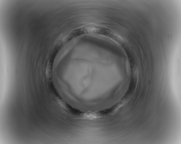 X0000085770181200704091359