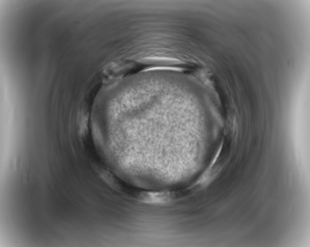 X0000085770188200704091359