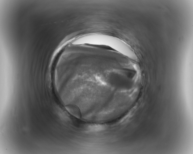 X0000085770198200704091359