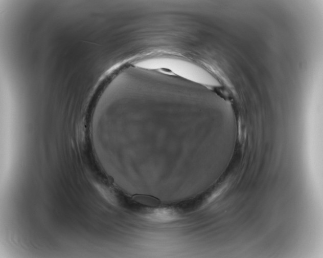 X0000085770204200704091358