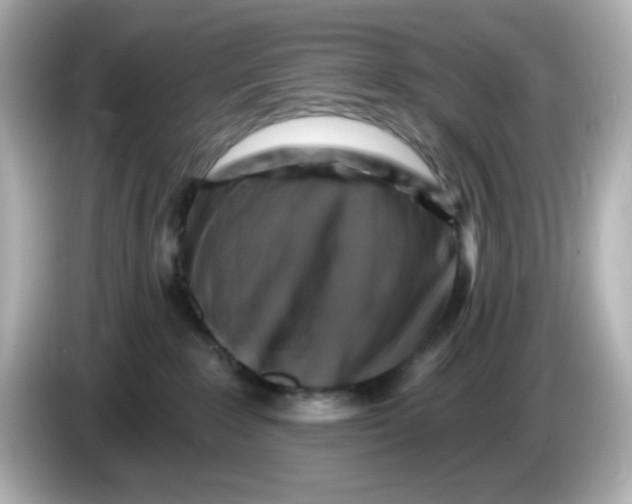 X0000085770235200704091358