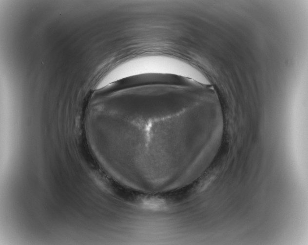 X0000085770258200704091358