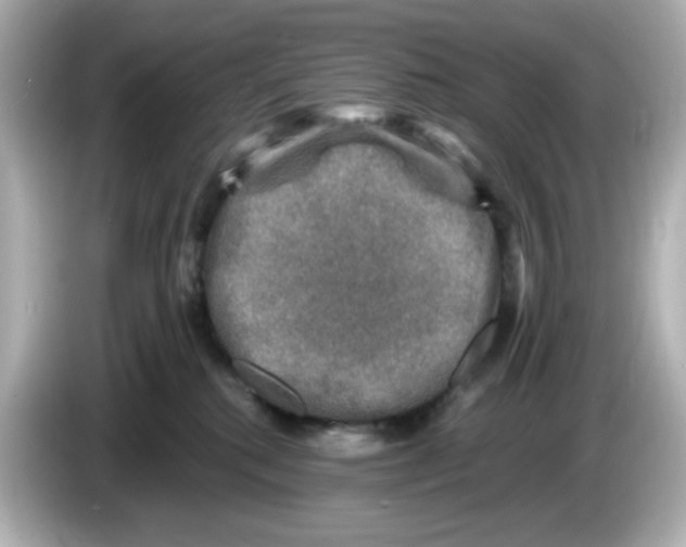 X0000085770280200704091358