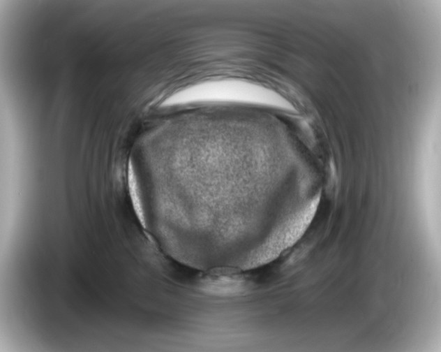 X0000085770329200704091357