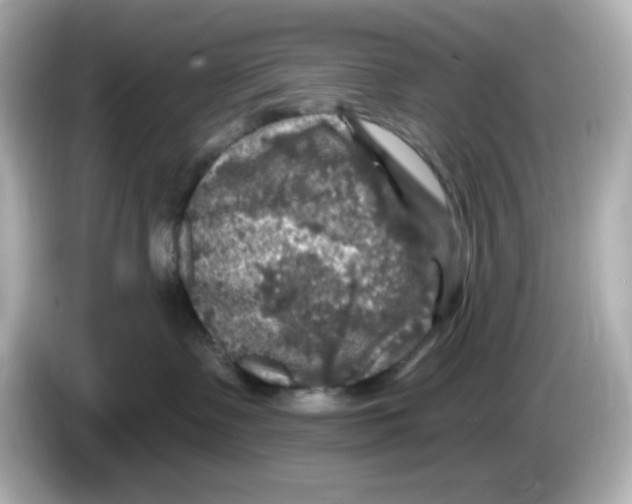 X0000085770335200704091357