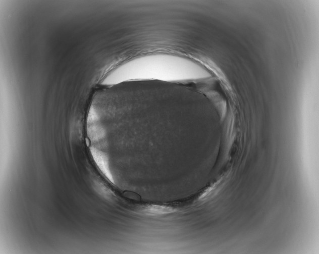 X0000085770393200704091356