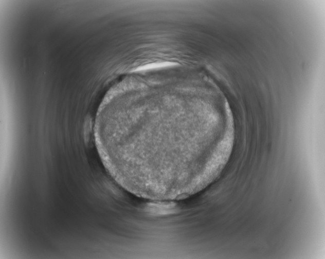 X0000085770480200704091356