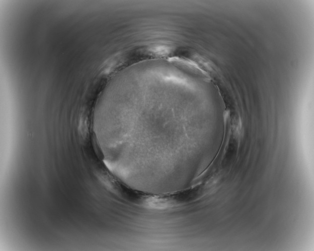 X0000085770568200704091355