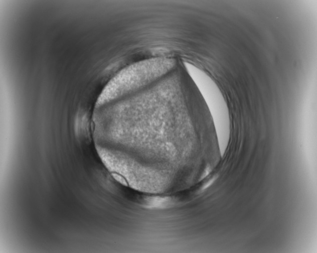 X0000085770575200704091355