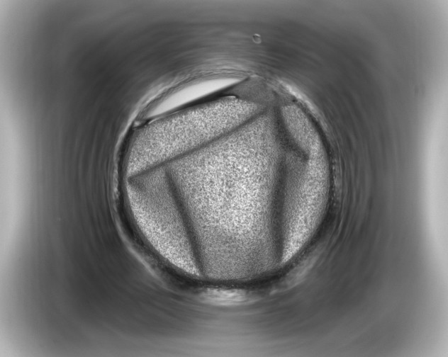 X0000085770582200704091354