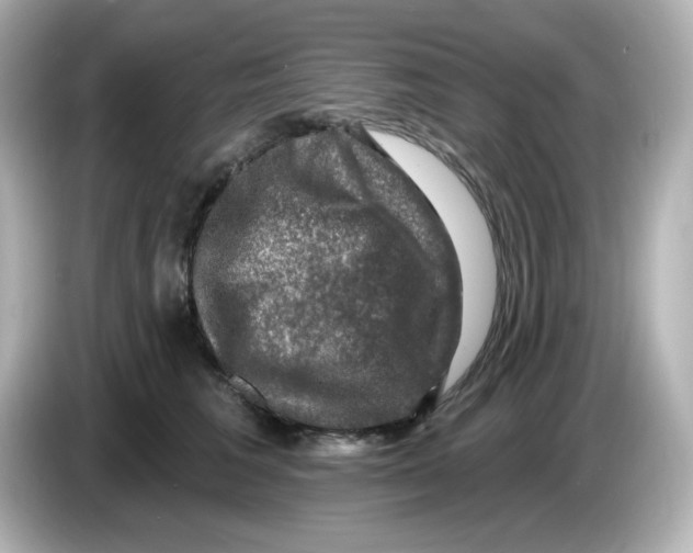 X0000085770613200704091354