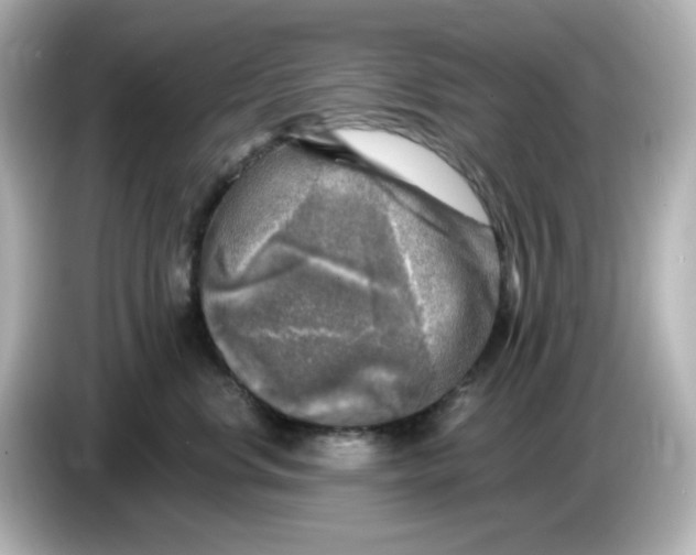 X0000085770668200704091354