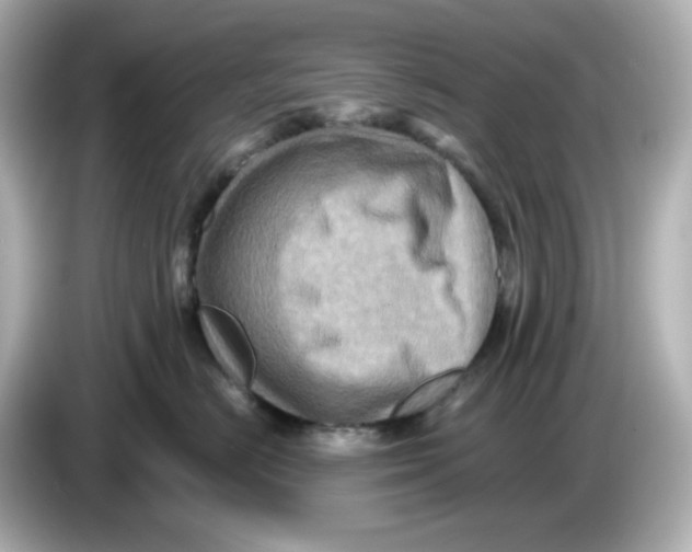 X0000085770670200704091354