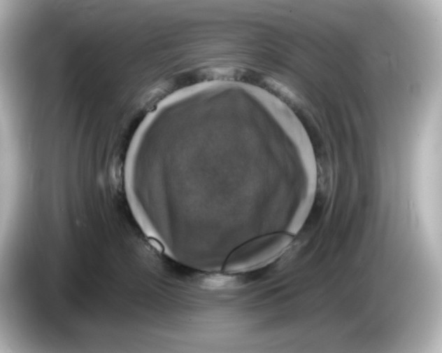 X0000085770718200704091352