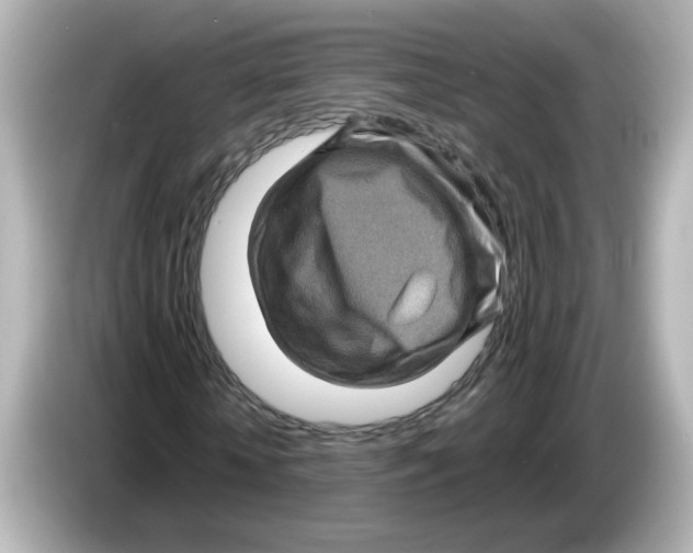 X0000085770818200704091351