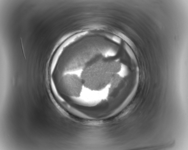 X0000085771055200704091349