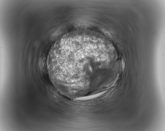 X0000085771059200704091348