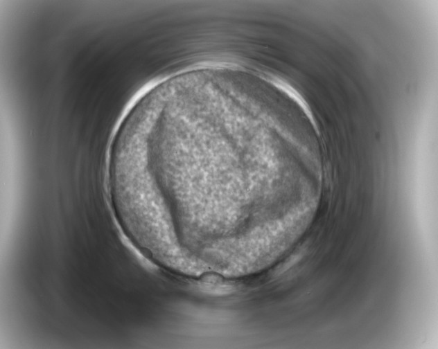 X0000085771103200704091348