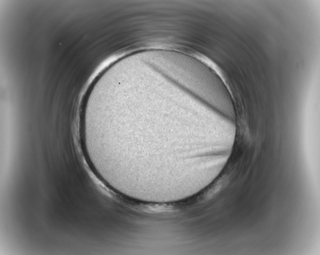 X0000085771147200704091348