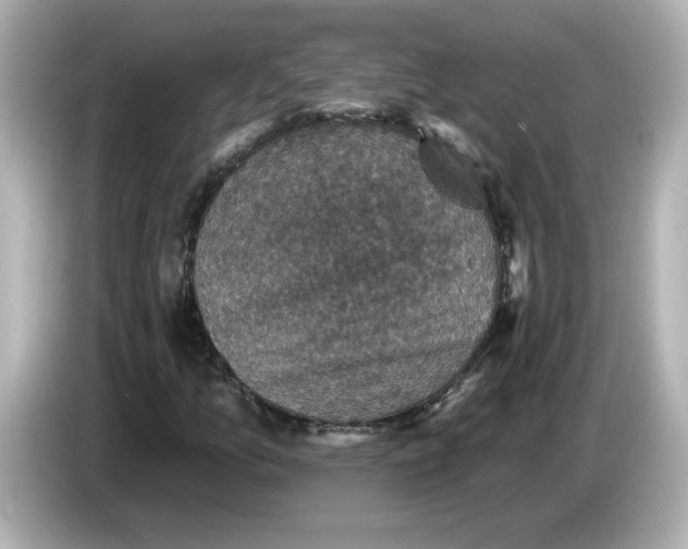 X0000085771157200704091347