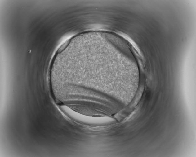 X0000085771285200704091346