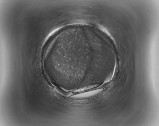 X0000085771312200704091345