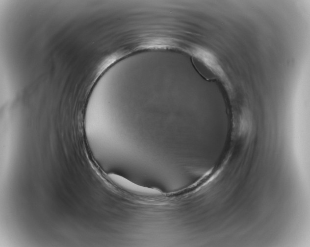 X0000085771329200704091346