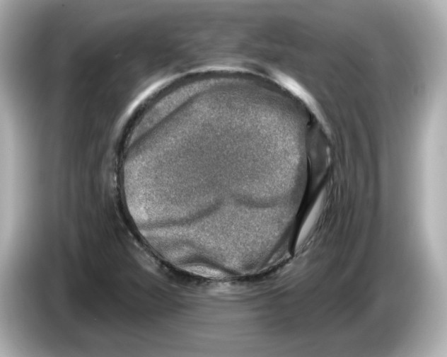 X0000085771360200704091345