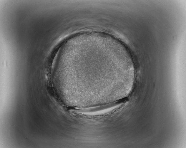 X0000085771496200704091343