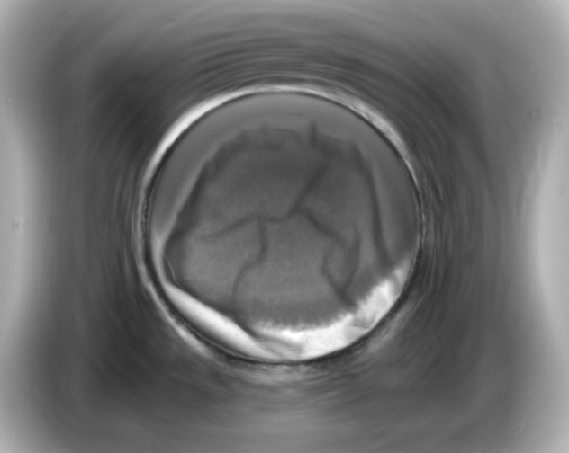 X0000085771533200704091343