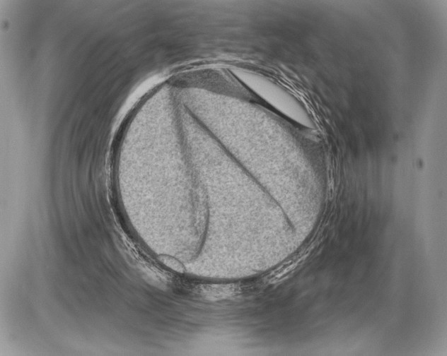 X0000085770102200704131813